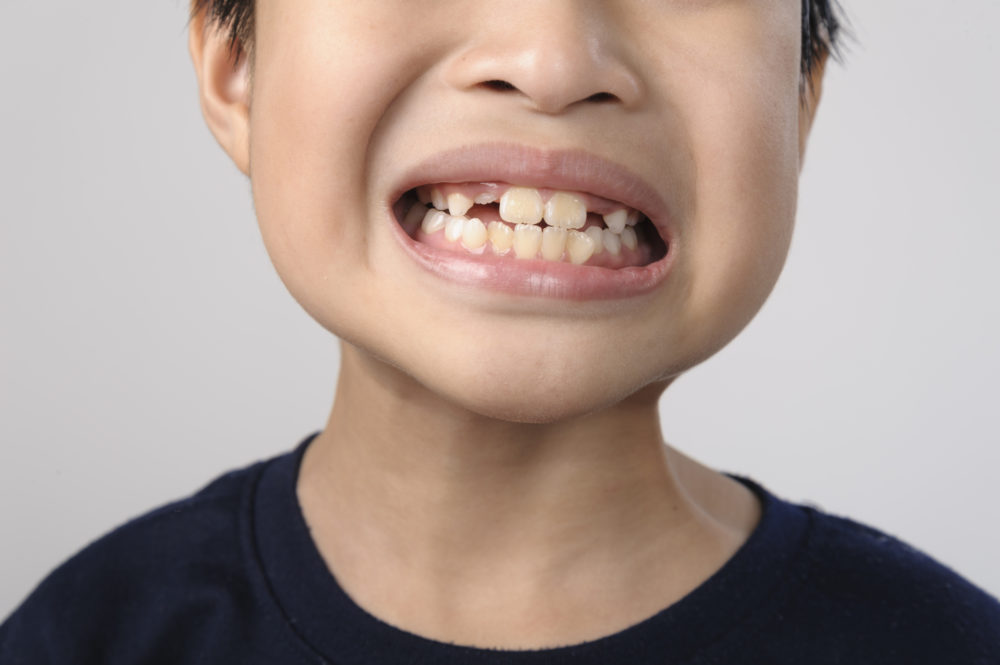 Pediatric-Dental-Assistant-School-Baby-Teeth-smile